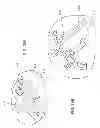 Fig. 23 - Expandable interbody spacer