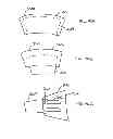Fig. 35 - Expandable interbody spacer
