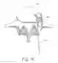Fig. 12 - Spinal fusion implant