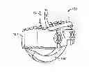 Fig. 01 - Stand alone interbody fixation system