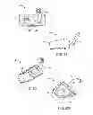 Fig. 03 - Stand alone interbody fixation system