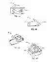 Fig. 04 - Stand alone interbody fixation system