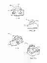 Fig. 05 - Stand alone interbody fixation system