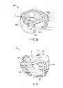 Fig. 08 - Stand alone interbody fixation system
