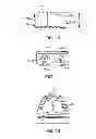 Fig. 09 - Stand alone interbody fixation system