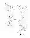 Fig. 10 - Stand alone interbody fixation system