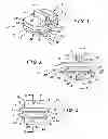 Fig. 02 - Intervertebral implant, insertion tool and method of inserting same