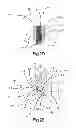 Fig. 05 - Intervertebral implant having extendable bone fixation members