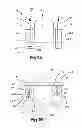 Fig. 08 - Intervertebral implant having extendable bone fixation members