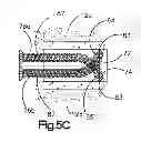 Fig. 15 - Intervertebral implant having extendable bone fixation members