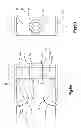 Fig. 27 - Intervertebral implant having extendable bone fixation members