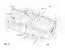 Fig. 03 - Systems and methods for spinal fusion