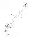 Fig. 11 - Systems and methods for spinal fusion