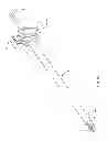 Fig. 17 - Systems and methods for spinal fusion