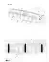 Fig. 20 - Systems and methods for spinal fusion