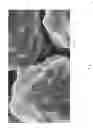 Fig. 03 - Porous, Stabilized Craniomaxillofacial Implants and Methods and Kits Relating Thereto