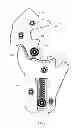 Fig. 05 - ROLLING-CONTACT KNEE PROSTHESIS