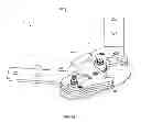 Fig. 08 - ROLLING-CONTACT KNEE PROSTHESIS