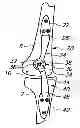 Fig. 01 - EXTRA-ARTICULAR IMPLANTABLE MECHANICAL ENERGY ABSORBING ASSEMBLIES HAVING TWO DEFLECTING MEMBERS AND METHODS