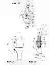 Fig. 08 - EXTRA-ARTICULAR IMPLANTABLE MECHANICAL ENERGY ABSORBING ASSEMBLIES HAVING TWO DEFLECTING MEMBERS AND METHODS