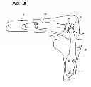 Fig. 13 - EXTRA-ARTICULAR IMPLANTABLE MECHANICAL ENERGY ABSORBING ASSEMBLIES HAVING TWO DEFLECTING MEMBERS AND METHODS