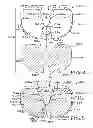 Fig. 04 - Tibial prosthesis