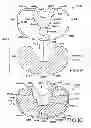 Fig. 07 - Tibial prosthesis