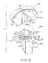 Fig. 11 - Tibial prosthesis