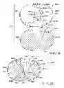 Fig. 13 - Tibial prosthesis
