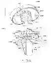 Fig. 14 - Tibial prosthesis