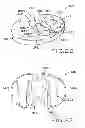 Fig. 15 - Tibial prosthesis