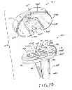 Fig. 17 - Tibial prosthesis