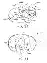 Fig. 18 - Tibial prosthesis