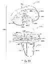 Fig. 20 - Tibial prosthesis
