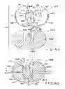 Fig. 28 - Tibial prosthesis