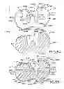 Fig. 34 - Tibial prosthesis