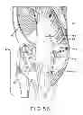 Fig. 35 - Tibial prosthesis