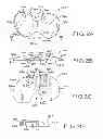 Fig. 03 - Provisional tibial prosthesis system