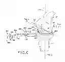 Fig. 07 - Provisional tibial prosthesis system