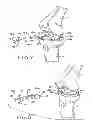 Fig. 08 - Provisional tibial prosthesis system