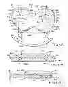 Fig. 10 - Provisional tibial prosthesis system