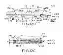 Fig. 13 - Provisional tibial prosthesis system