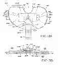 Fig. 14 - Provisional tibial prosthesis system