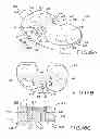 Fig. 16 - Provisional tibial prosthesis system