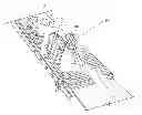 Fig. 01 - Patient-specific hip joint devices