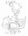 Fig. 06 - Patient-specific hip joint devices