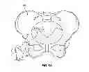 Fig. 07 - Patient-specific hip joint devices