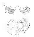 Fig. 10 - Patient-specific hip joint devices