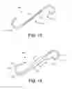 Fig. 08 - COMFORT STENTS