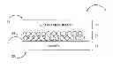 Fig. 01 - Tissue grafts composed of micronized placental tissue and methods of making and using the same